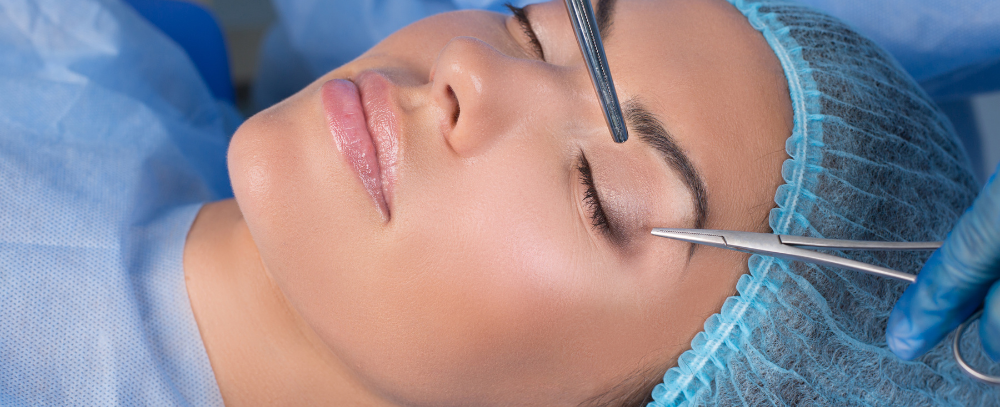 Eyelid Surgery( Eyelift or Blepharoplasty)