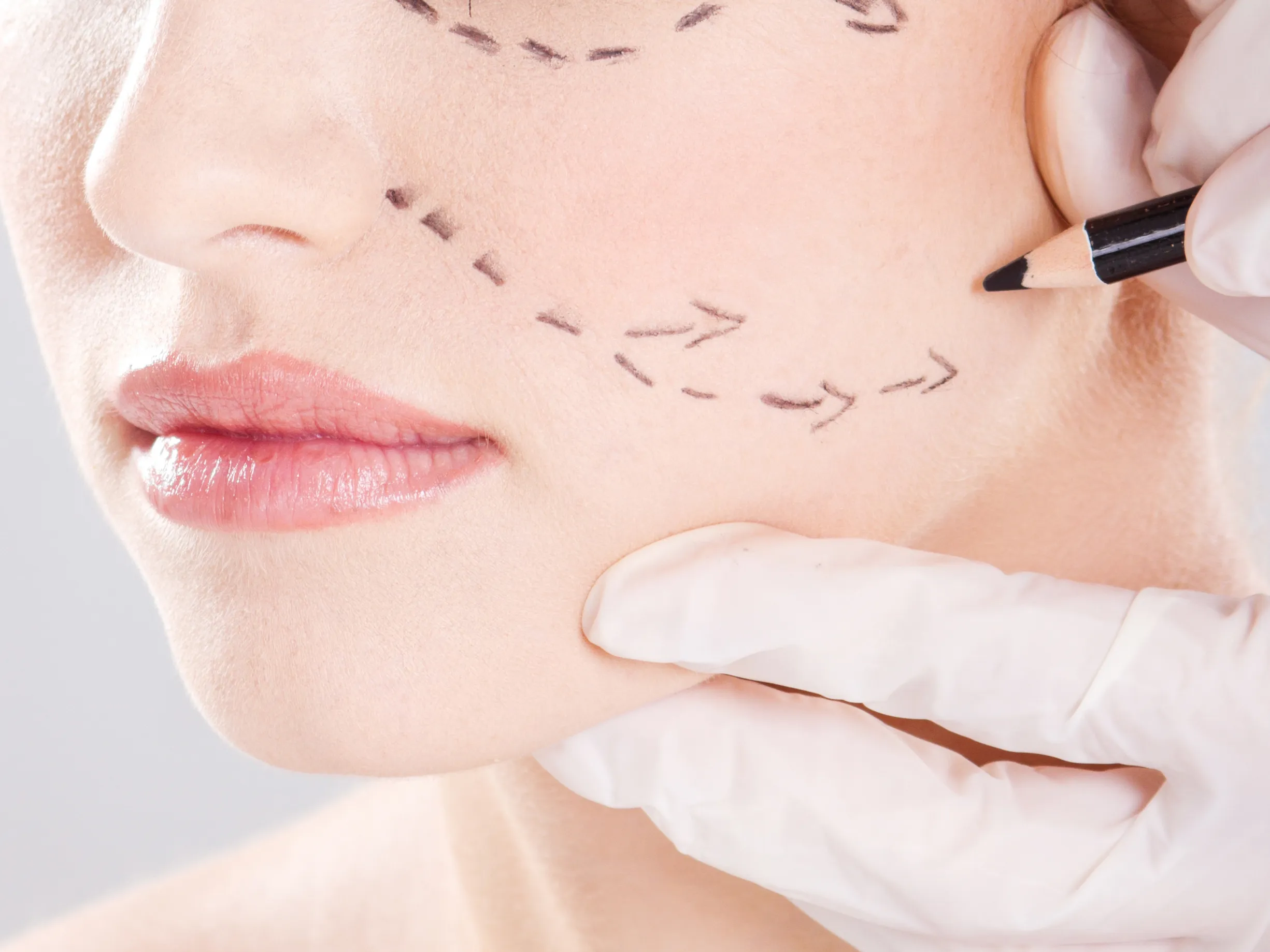 Endoscopic Facial Surgeries